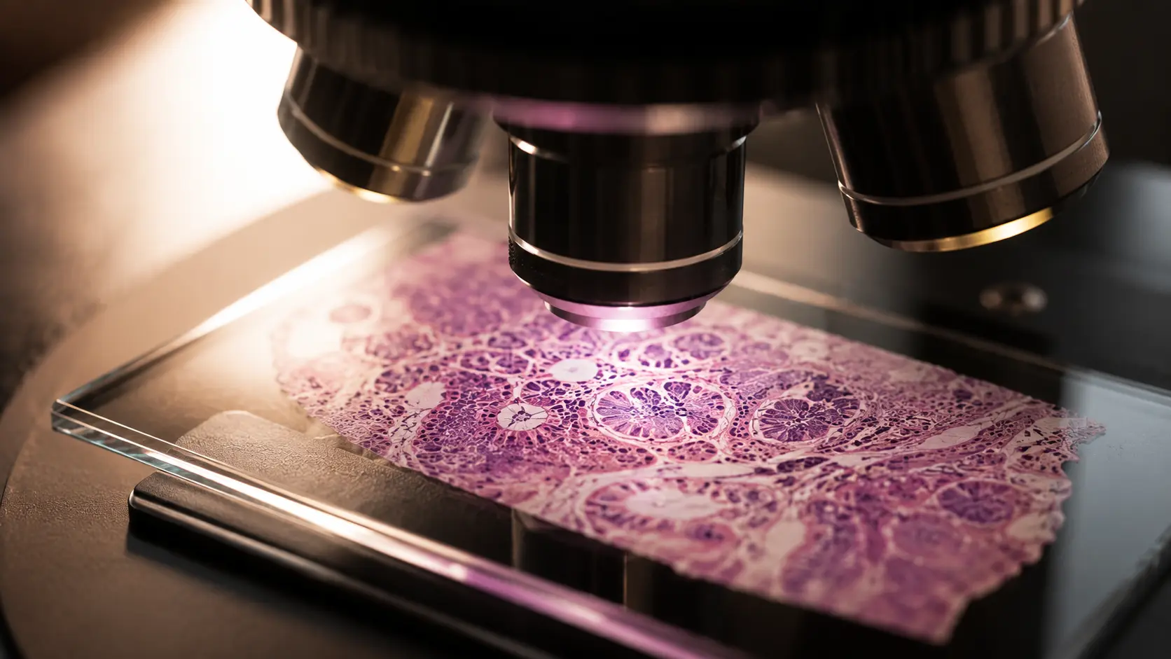 Endometrial Cancer